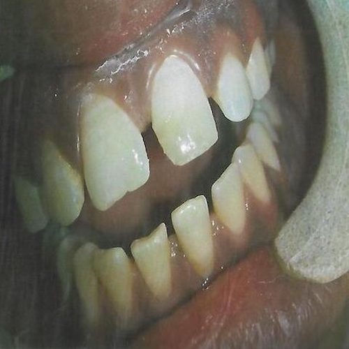 dental-5_after-e1593779590319
