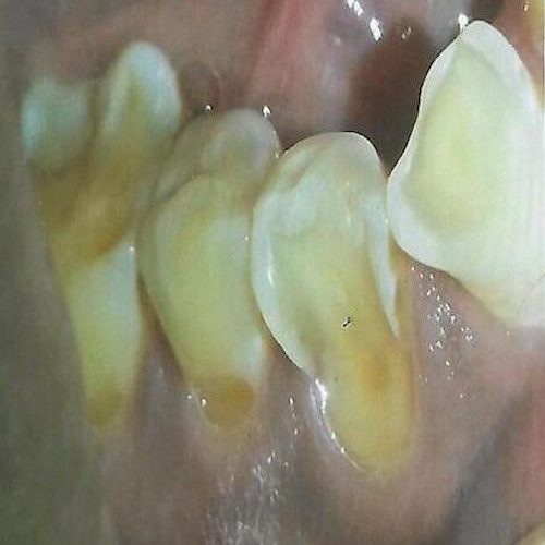 dental-6_before-e1593779607131